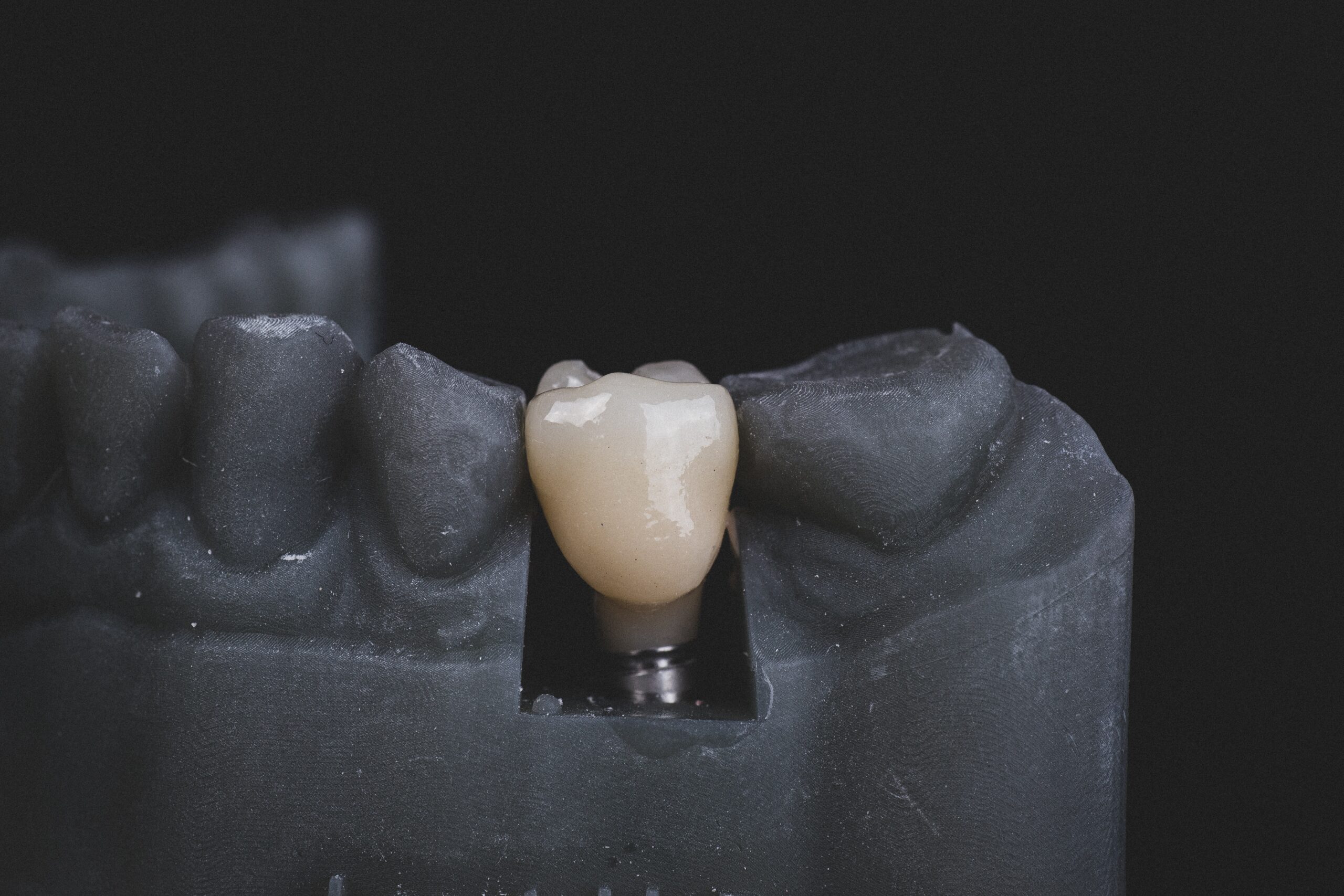 bogdan-condr-q1KLbswF70Y-unsplash Oral Surgery